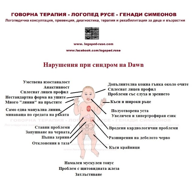 Логопед в Русе; логопедична помощ в Русе; логопеди в Русе; добър логопед в Русе; добри логопеди в Русе; как да се справя с говорния си дефект - проблем; коригиране на говорен дефект в Русе; говорен терапевт в Русе; как да намеря логопед в Русе; детски логопед; добър детски логопед; логопед за възрастни в Русе; логопедични центрове в Русе; логопедичен център в Русе, логопедичен кабинет в Русе; логопедични кабинети в Русе; Логопедична помощ при деца с аутизъм; Афазия; мозъчен инсулт Русе; късно проговаряне логопедична помощ; Блокиране на говора; възстановяване след прекаран инсулт в Русе, Генерализирани разстройства на развитието помощ в Русе; Дислексия; Заекване; Затруднения за смятане и сметни операции; Затруднения при писане; Затруднения при четене;Помощ при аутизъм в Русе; Късно начало на речта; Липса на реч; Нарушение на звукопроизношението; Общо недоразвитие на речта; Поражения на ЦНС (централната нервна система); Разпад на речта в резултат на инсулт и възстановяване в Русе; Разстройства от аутистичния спектър в Русе, помощ на деца от аутистичен спектър в Русе; Специфични обучителни трудности; Хиперактивност с или без дефицит на вниманието; Церебрална парализа; аутизъм Русе; внимание и памет Русе; Замяна или неправилно произнасяне на един звук или групи звукове; деца езикови говорни нарушения консултация и корекция логопедичен кабинет Русе; логопедични занимания логопед Русе; логопед Русе; менингит-енцефалит; слуховото и тактилно възприятие; черепно-мозъчна травма засягане на говора и речта помощ в Русе; логопедична помощ при деца с увреждания; деца аутисти в Русе; нарушения на общуването при деца с увреждания Русе; детето ми заеква помощ; добър логопед в Русе; заекване Логопед в Русе; Логопеди в Русе; добри логопеди в Русе; добър логопед в Русе; заекване при възрастни; заекване лечение; заекване при деца лечение Русе; заекване от уплаха Русе; корекция на заекване при деца Русе; заекване при малки деца; заекване хомеопатия; заекване лекуване.