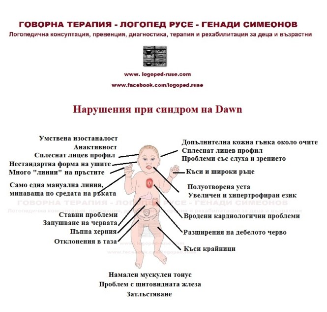 Логопед в Русе; логопедична помощ в Русе; логопеди в Русе; добър логопед в Русе; добри логопеди в Русе; как да се справя с говорния си дефект - проблем; коригиране на говорен дефект в Русе; говорен терапевт в Русе; как да намеря логопед в Русе; детски логопед; добър детски логопед; логопед за възрастни в Русе; логопедични центрове в Русе; логопедичен център в Русе, логопедичен кабинет в Русе; логопедични кабинети в Русе; Логопедична помощ при деца с аутизъм; Афазия; мозъчен инсулт Русе; късно проговаряне логопедична помощ; Блокиране на говора; възстановяване след прекаран инсулт в Русе, Генерализирани разстройства на развитието помощ в Русе; Дислексия; Заекване; Затруднения за смятане и сметни операции; Затруднения при писане; Затруднения при четене;Помощ при аутизъм в Русе; Късно начало на речта; Липса на реч; Нарушение на звукопроизношението; Общо недоразвитие на речта; Поражения на ЦНС (централната нервна система); Разпад на речта в резултат на инсулт и възстановяване в Русе; Разстройства от аутистичния спектър в Русе, помощ на деца от аутистичен спектър в Русе; Специфични обучителни трудности; Хиперактивност с или без дефицит на вниманието; Церебрална парализа; аутизъм Русе; внимание и памет Русе; Замяна или неправилно произнасяне на един звук или групи звукове; деца езикови говорни нарушения консултация и корекция логопедичен кабинет Русе; логопедични занимания логопед Русе; логопед Русе; менингит-енцефалит; слуховото и тактилно възприятие; черепно-мозъчна травма засягане на говора и речта помощ в Русе; логопедична помощ при деца с увреждания; деца аутисти в Русе; нарушения на общуването при деца с увреждания Русе; детето ми заеква помощ; добър логопед в Русе; заекване Логопед в Русе; Логопеди в Русе; добри логопеди в Русе; добър логопед в Русе; заекване при възрастни; заекване лечение; заекване при деца лечение Русе; заекване от уплаха Русе; корекция на заекване при деца Русе; заекване при малки деца; заекване хомеопатия; заекване лекуване.
