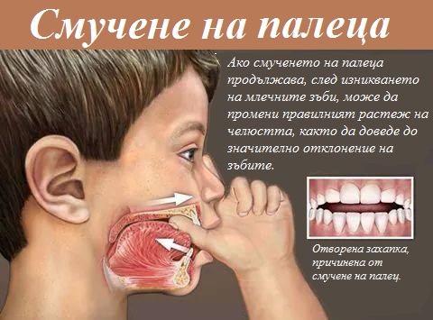 =Логопед в Русе; логопедична помощ в Русе; логопеди в Русе; добър логопед в Русе; добри логопеди в Русе; как да се справя с говорния си дефект - проблем; коригиране на говорен дефект в Русе; говорен терапевт в Русе; как да намеря логопед в Русе; детски логопед; добър детски логопед; логопед за възрастни в Русе; логопедични центрове в Русе; логопедичен център в Русе, логопедичен кабинет в Русе; логопедични кабинети в Русе; Логопедична помощ при деца с аутизъм; Афазия; мозъчен инсулт Русе; късно проговаряне логопедична помощ; Блокиране на говора; възстановяване след прекаран инсулт в Русе, Генерализирани разстройства на развитието помощ в Русе; Дислексия; Заекване; Затруднения за смятане и сметни операции; Затруднения при писане; Затруднения при четене;Помощ при аутизъм в Русе; Късно начало на речта; Липса на реч; Нарушение на звукопроизношението; Общо недоразвитие на речта; Поражения на ЦНС (централната нервна система); Разпад на речта в резултат на инсулт и възстановяване в Русе; Разстройства от аутистичния спектър в Русе, помощ на деца от аутистичен спектър в Русе; Специфични обучителни трудности; Хиперактивност с или без дефицит на вниманието; Церебрална парализа; аутизъм Русе; внимание и памет Русе; Замяна или неправилно произнасяне на един звук или групи звукове; деца езикови говорни нарушения консултация и корекция логопедичен кабинет Русе; логопедични занимания логопед Русе; логопед Русе; менингит-енцефалит; слуховото и тактилно възприятие; черепно-мозъчна травма засягане на говора и речта помощ в Русе; логопедична помощ при деца с увреждания; деца аутисти в Русе; нарушения на общуването при деца с увреждания Русе; детето ми заеква помощ; добър логопед в Русе; заекване Логопед в Русе; Логопеди в Русе; добри логопеди в Русе; добър логопед в Русе; заекване при възрастни; заекване лечение; заекване при деца лечение Русе; заекване от уплаха Русе; корекция на заекване при деца Русе; заекване при малки деца; заекване хомеопатия; заекване лекуване.