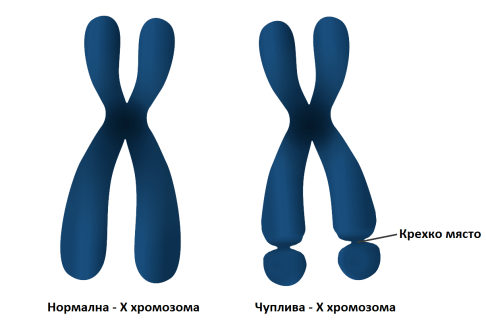 причини за аутизма